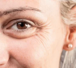 Tratamiento anti-ojeras efecto Lifting